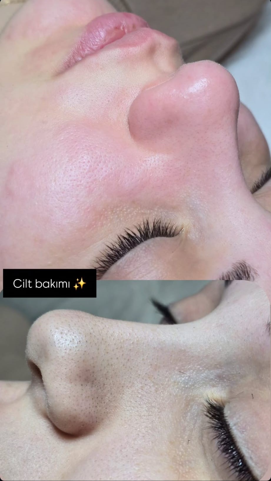 Klasik Cilt Bakımı Samsun – İstek Lady Güzellik Salonu